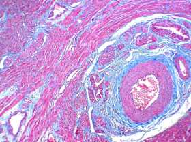 Trichrome Adhesion Slides