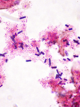 Gram 2 Tissue Adhesion Slides