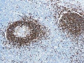 Hairy Cell Leukemia, Clone DBA.44, 10ml