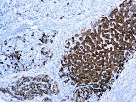 Hepatocyte Specific Antigen, Clone OCH1E5, 10ml