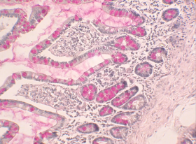 Mucicarmine Adhesion Slides