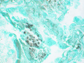 Pneumocystis Adhesion Slides