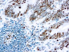RB (Retinoblastoma Gene Protein), Clone 1F8